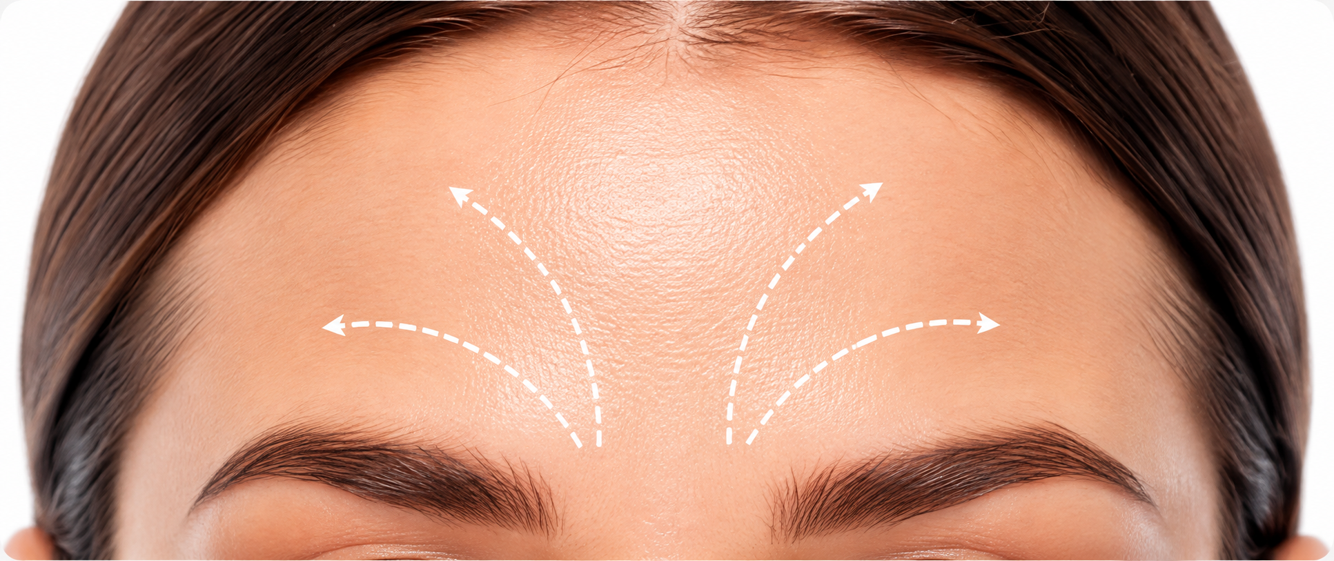 Zona de la frente para tratamiento facial