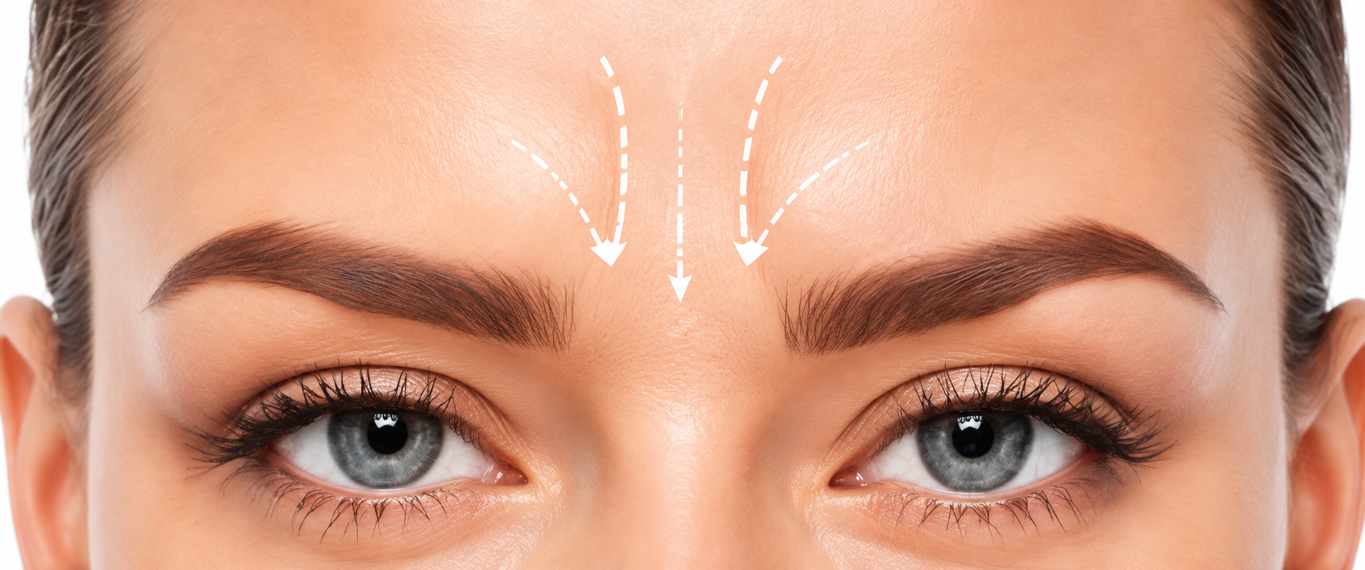 Zona del entrecejo para tratamiento facial
