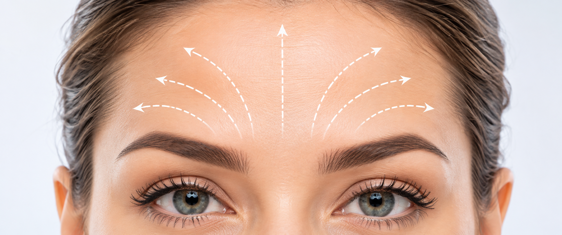 Rostro para tratamiento HIFU 12 y rejuvenecimiento facial